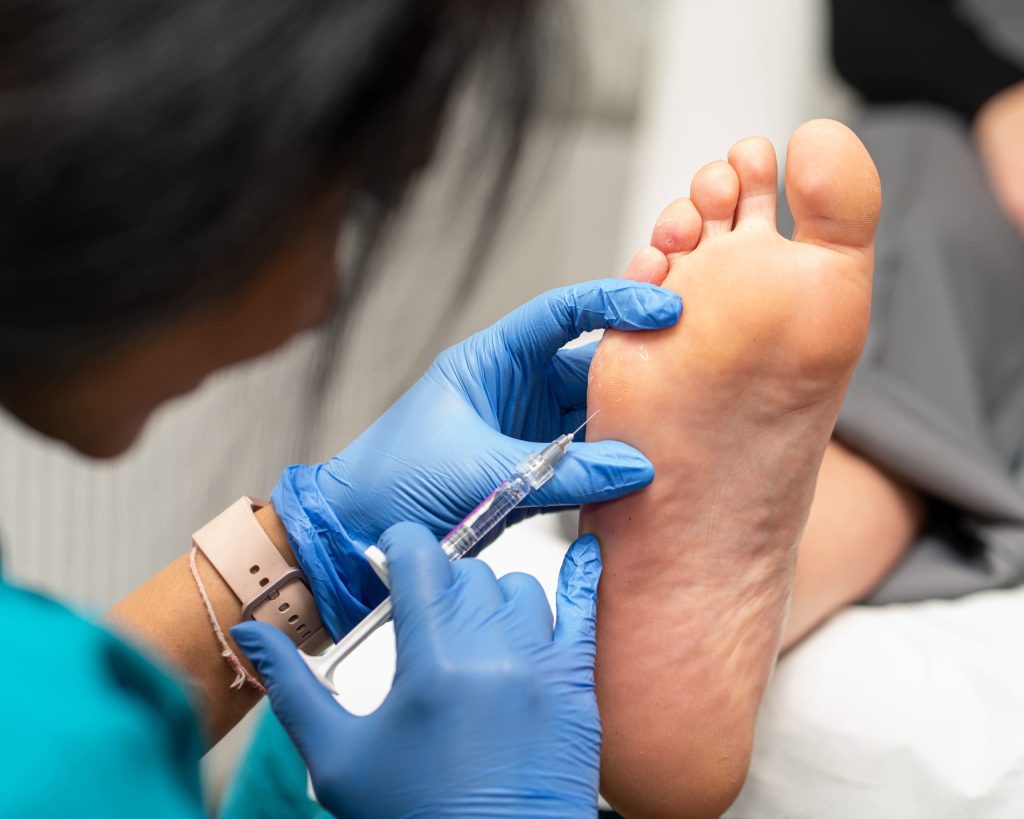 Fat Pad Replacement Injections – Expert Foot & Ankle Care